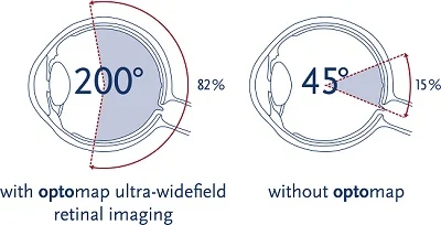 Comparing retinal imaging technologies