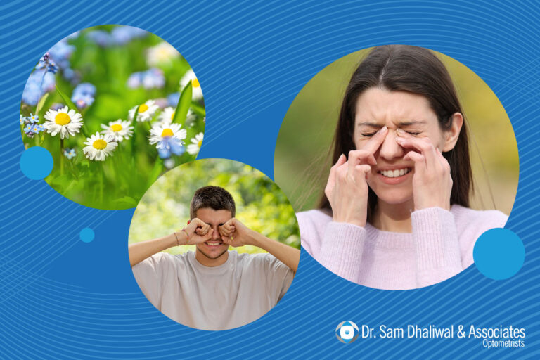Managing Itchy Eyes Due to Allergies
